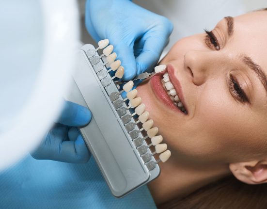 EGR: Esthetic Guided Restoration, un sistema guidato per il restauro facilitato dei settori anteriori.