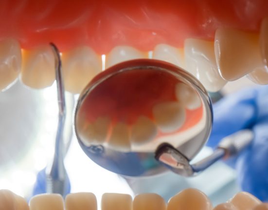Odontoiatria conservativa e tecniche di assistenza