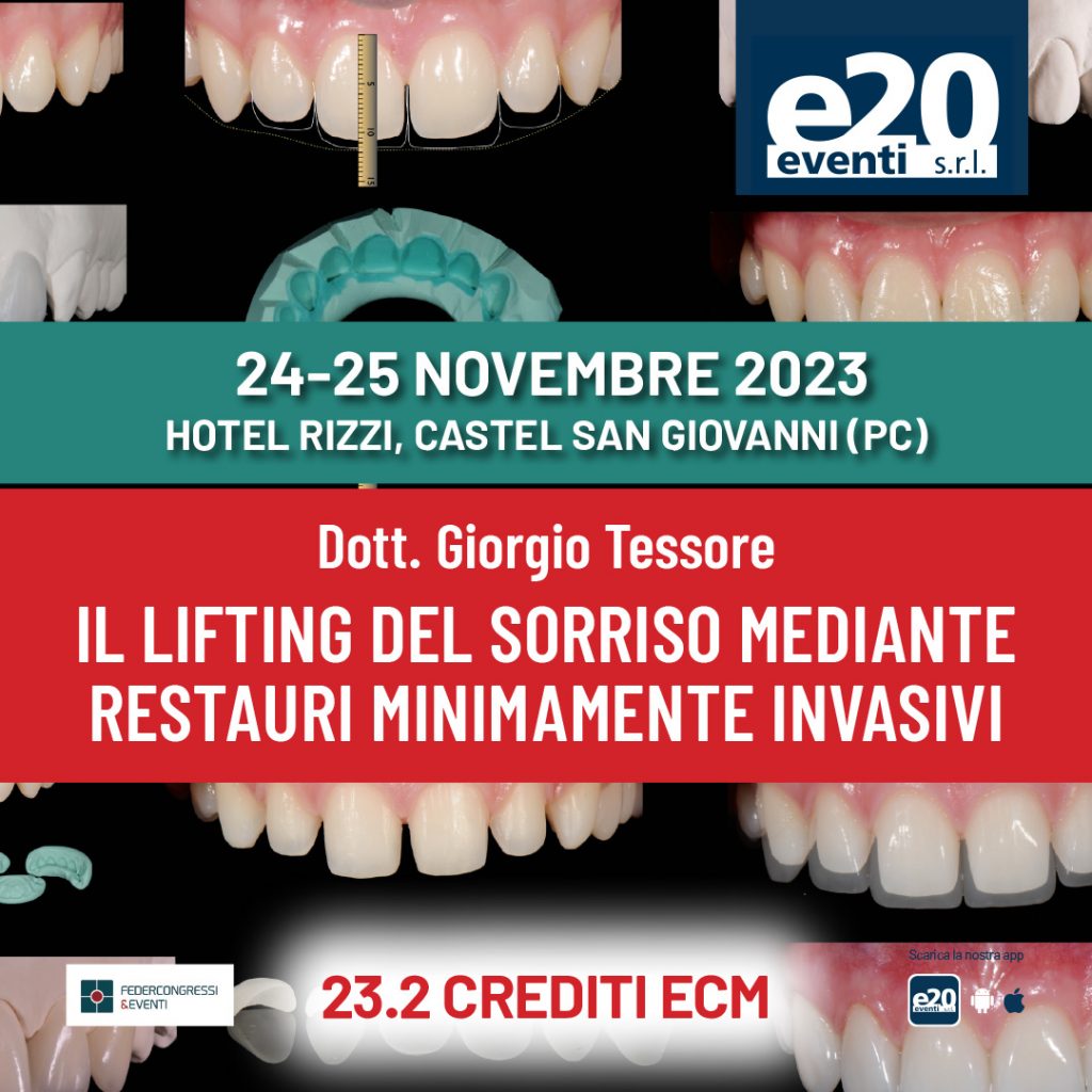Il lifting del sorriso mediante restauri minimamente invasivi