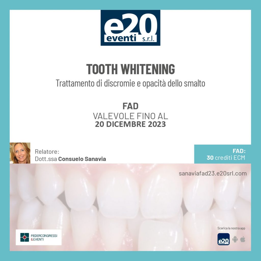 Tooth whitening: trattamento di discromie e opacità dello smalto
