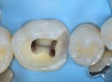 ENDODONZIA BASE IN MICROSCOPIA