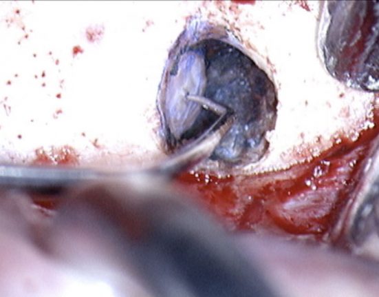 La moderna endodonzia nel piano di trattamento globale