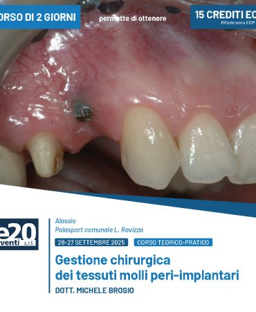 DOTT. MICHELE BROSIO - Gestione chirurgica dei tessuti molli peri-implantari