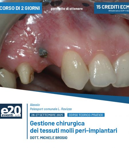 DOTT. MICHELE BROSIO - Gestione chirurgica dei tessuti molli peri-implantari