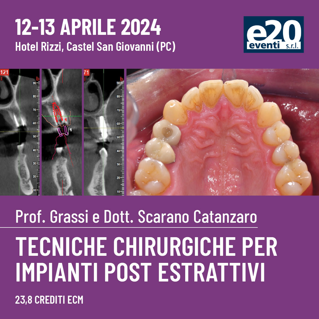 Prof. Grassi, Dott. Scarano Catanzaro - Tecniche chirurgiche per impianti post estrattivi
