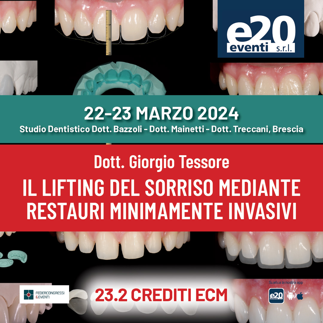 Tessore - Il lifting del sorriso mediante restauri minimamente invasivi