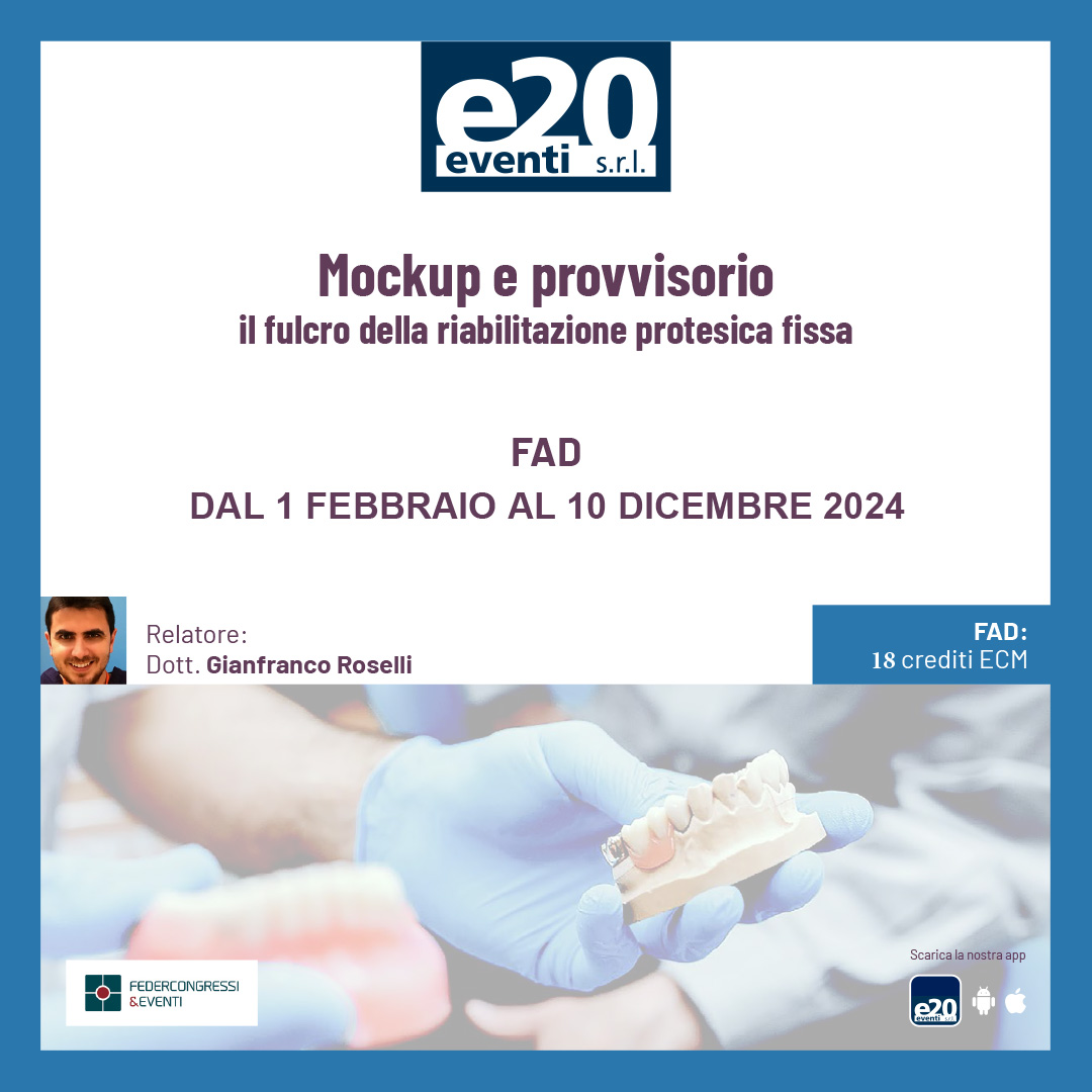 Dott. Roselli - Mockup e provvisorio il fulcro della riabilitazione protesica fissa