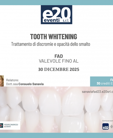 Dott.ssa Sanavia - TOOTH WHITENING: Trattamento di discromie e opacità dello smalto
