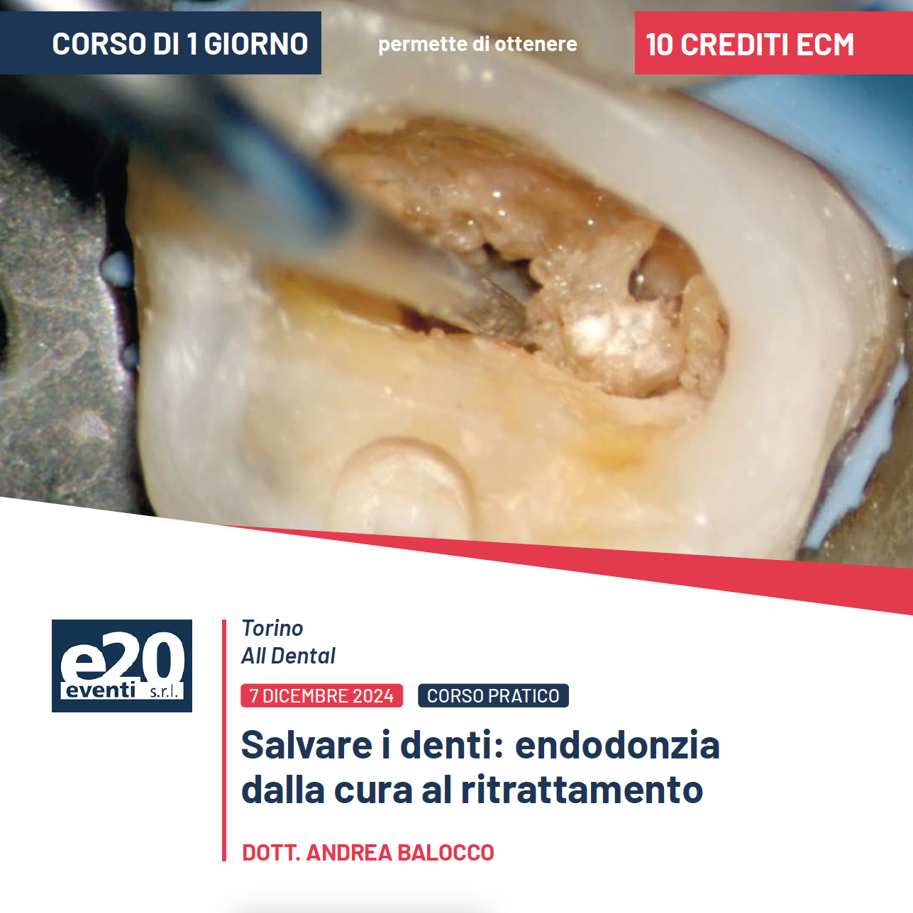 Dott. Balocco - SALVARE I DENTI: Endodonzia dalla cura al ritrattamento - 7 DICEMBRE