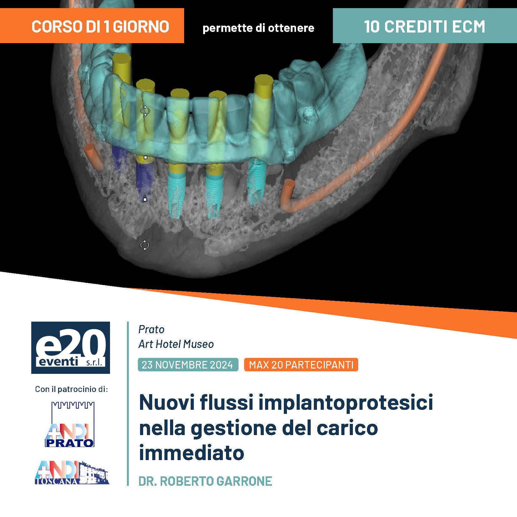 Dr. Garrone - Nuovi flussi implantoprotesici nella gestione del carico immediato