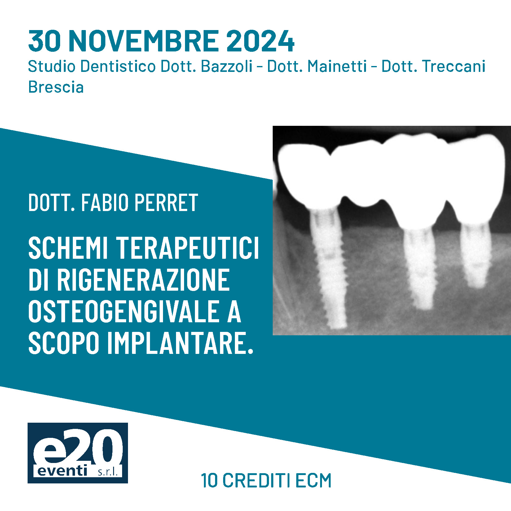 DOTT. PERRET "SCHEMI TERAPEUTICI DI RIGENERAZIONE OSTEOGENGIVALE A SCOPO IMPLANTARE"