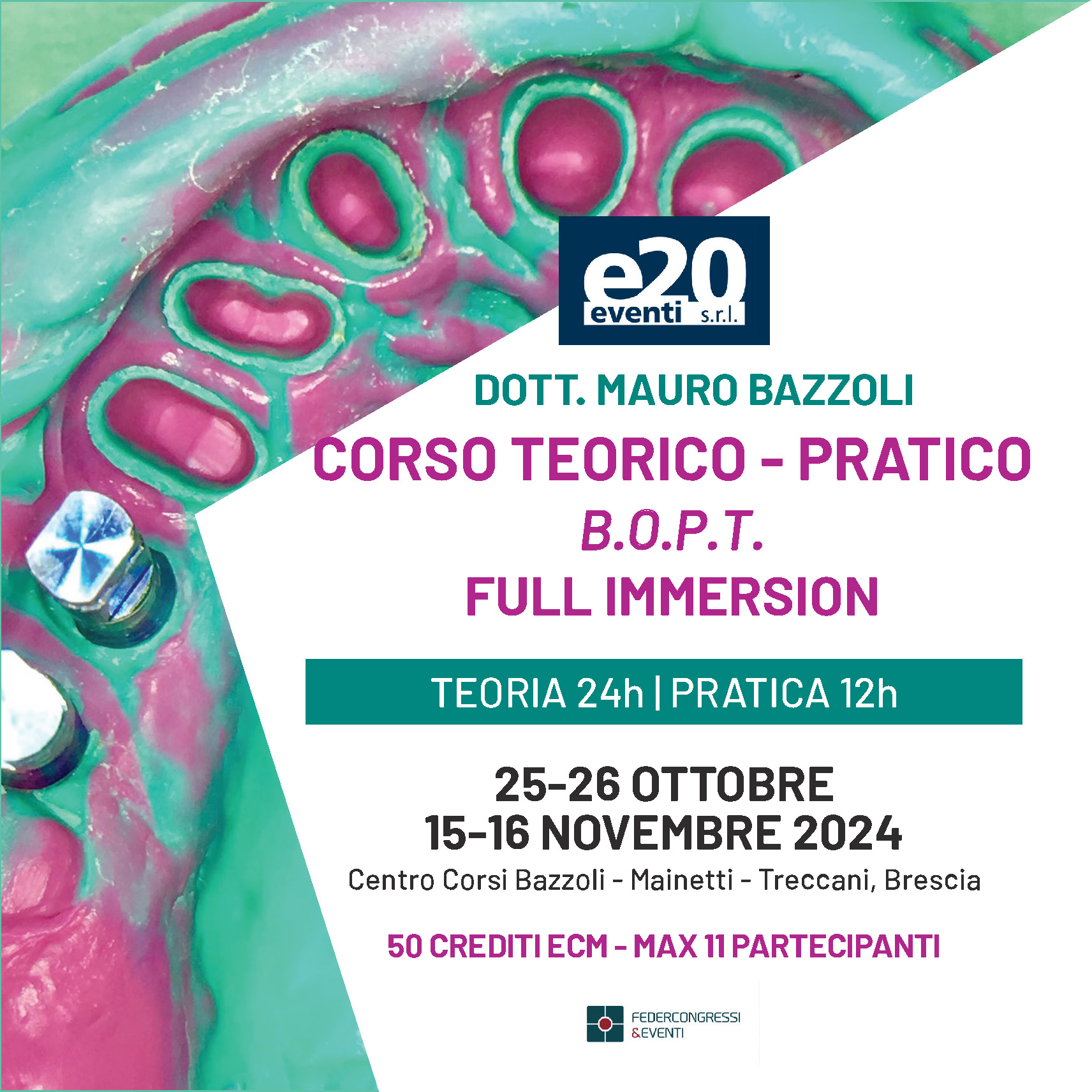 Dott. Bazzoli - Corso Teorico Pratico - Full Immersion Le preparazioni con Tecnica B.O.P.T.