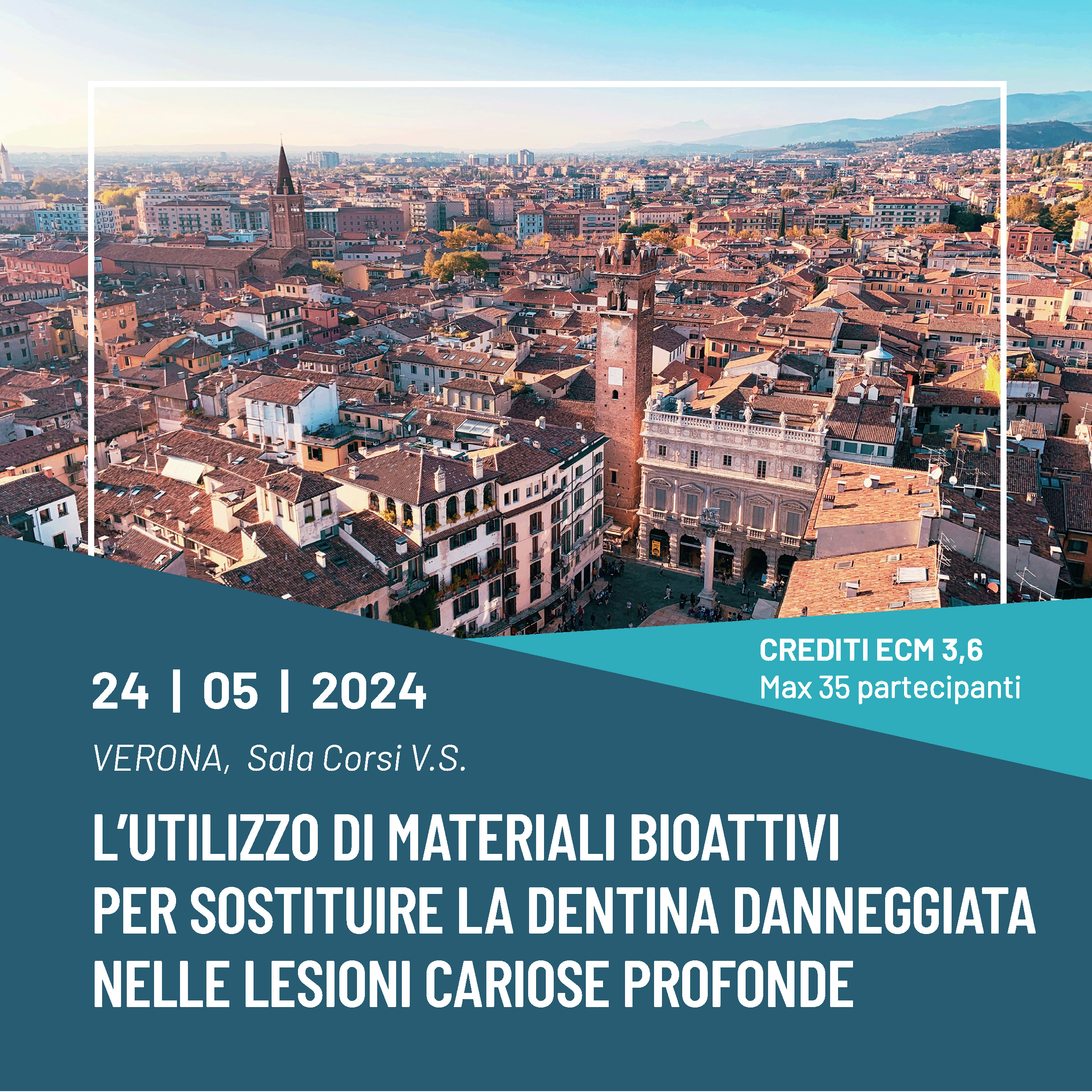 L’utilizzo di materiali bioattivi per sostituire la dentina danneggiata nelle lesioni cariose profonde