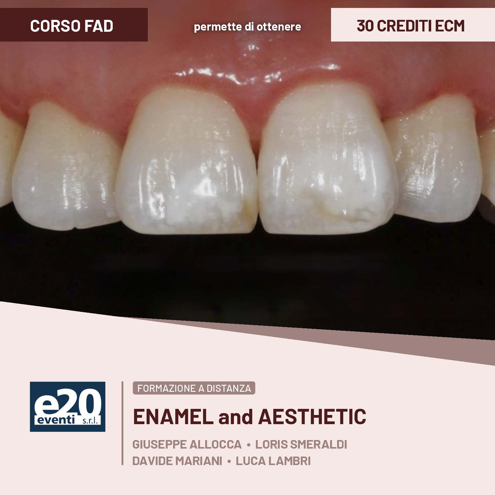 FAD Enamel and Aesthetic