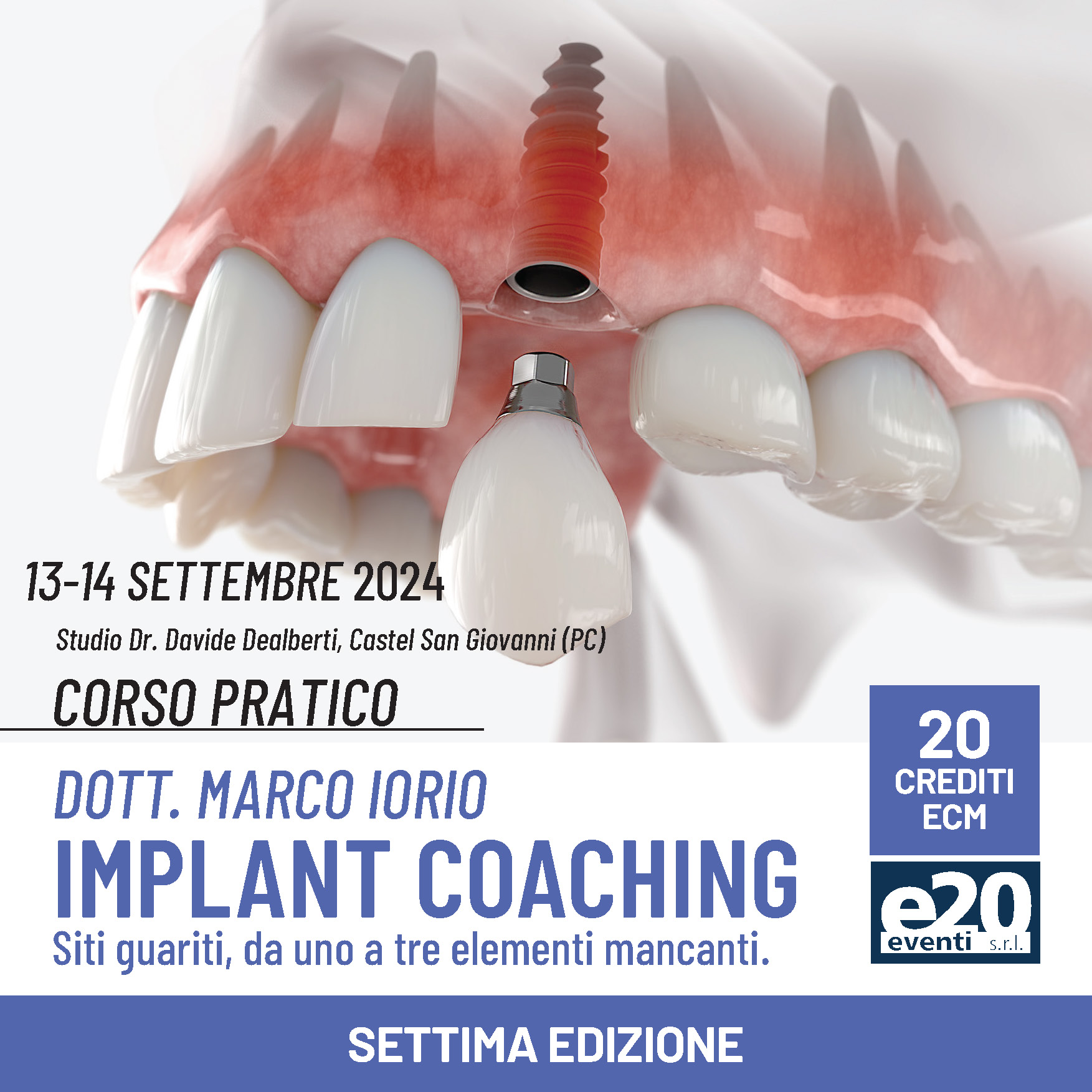 Dott. Iorio - Implant Coaching. Siti guariti, da uno a tre elementi mancanti.