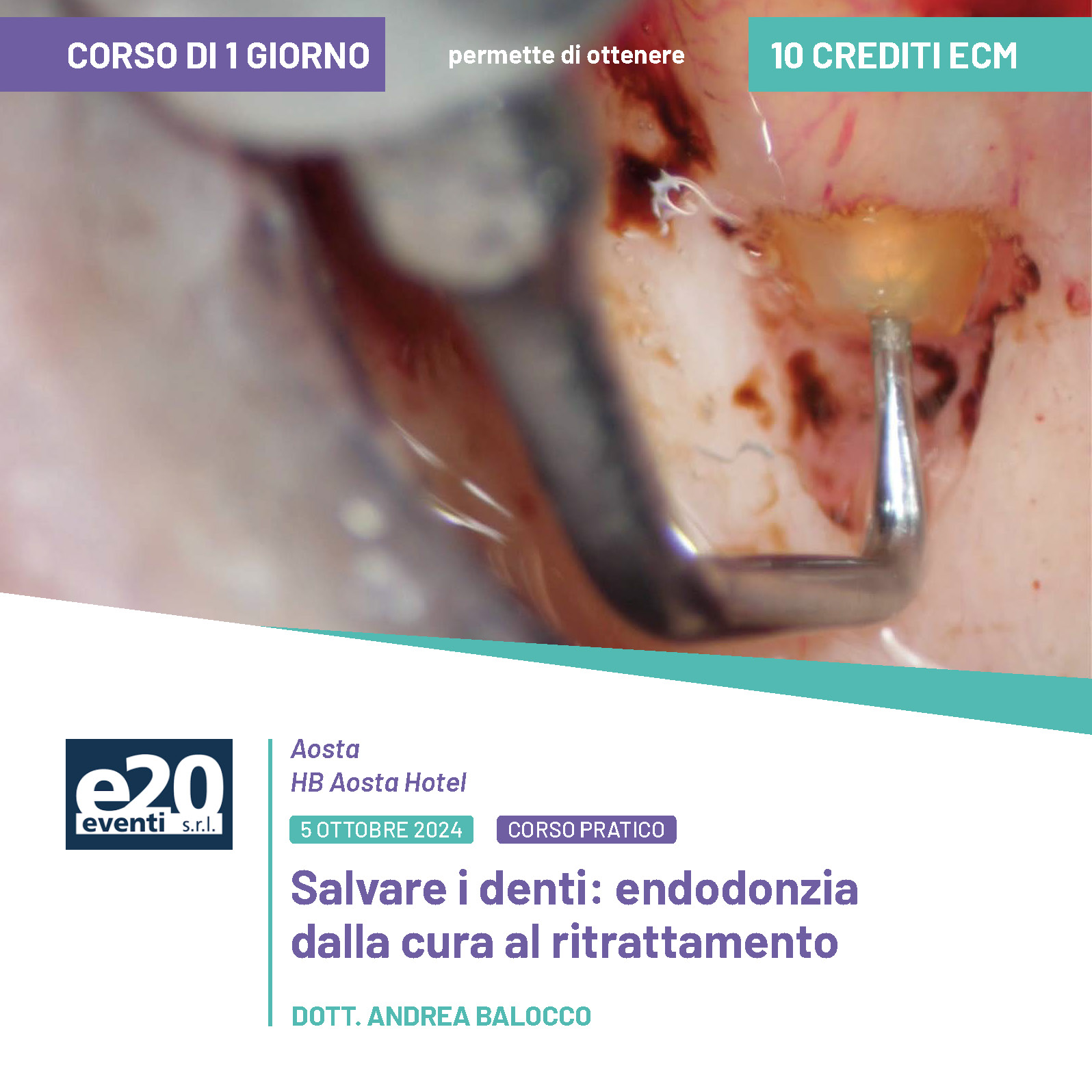 Dott. Balocco - Salvare i denti: endodonzia dalla cura al ritrattamento