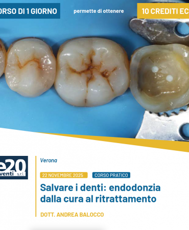 Dott. Balocco - SALVARE I DENTI: Endodonzia dalla cura al ritrattamento - VERONA