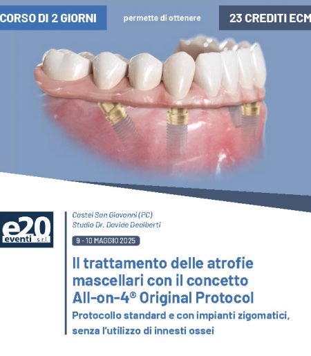 Dr. Pitino - Il trattamento delle atrofie mascellari con il concetto All-on-4® Original protocol