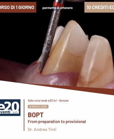Dott. Andrea Tinti - BOPT From preparation to provisional - GENOVA