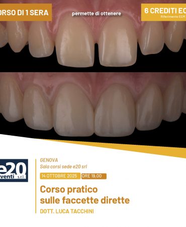 Dott. Tacchini - Corso pratico sulle faccette dirette - GENOVA