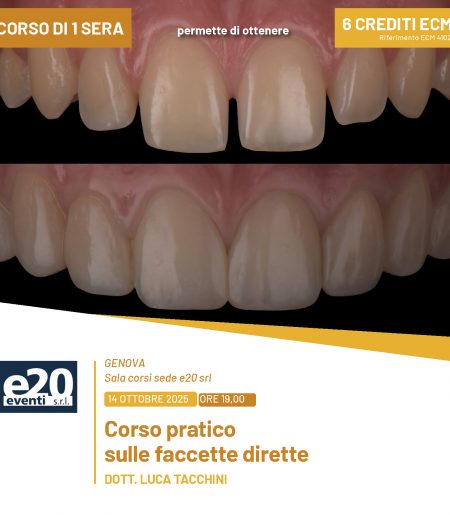 Dott. Tacchini - Corso pratico sulle faccette dirette - GENOVA