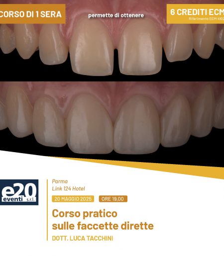 Dott. Tacchini - Corso pratico sulle faccette dirette - PARMA