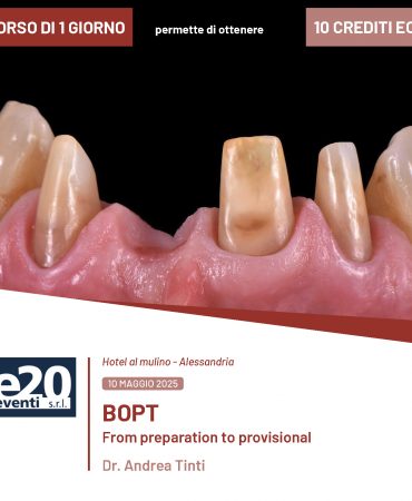 Dott. Andrea Tinti - BOPT From preparation to provisional - ALESSANDRIA