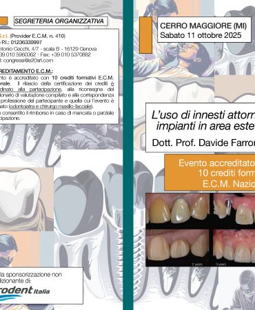 L’uso di innesti attorno a impianti in area estetica - Dott. Prof. Davide Farronato