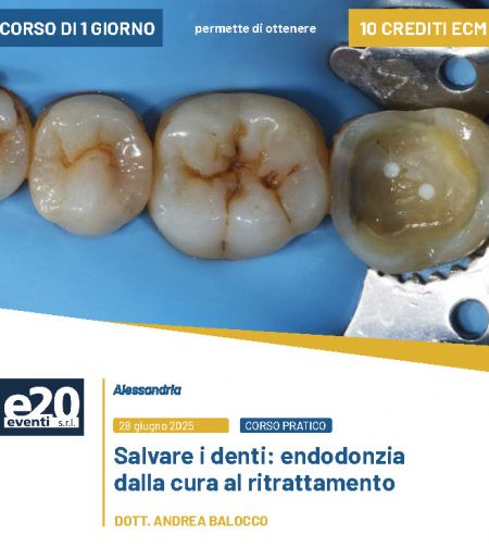 Dott. Balocco - SALVARE I DENTI: Endodonzia dalla cura al ritrattamento - ALESSANDRIA