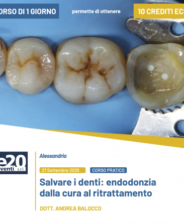 Dott. Balocco - SALVARE I DENTI: Endodonzia dalla cura al ritrattamento - ALESSANDRIA