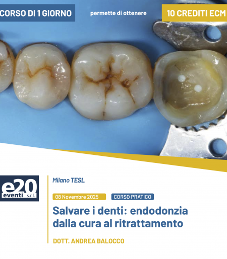 Dott. Balocco - SALVARE I DENTI: Endodonzia dalla cura al ritrattamento - MILANO