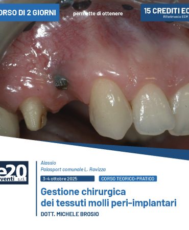 DOTT. MICHELE BROSIO - Gestione chirurgica dei tessuti molli peri-implantari