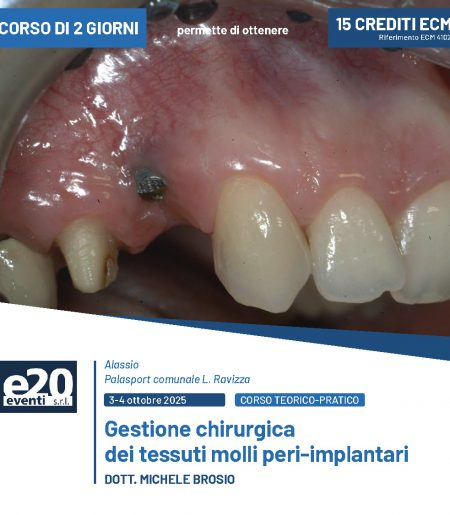 DOTT. MICHELE BROSIO - Gestione chirurgica dei tessuti molli peri-implantari
