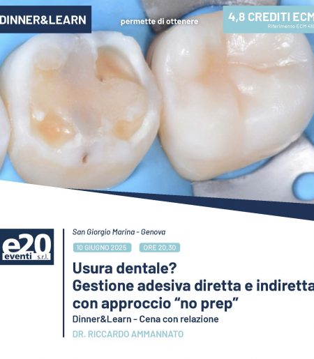 DR. RICCARDO AMMANNATO - Usura dentale?  Gestione adesiva diretta e indiretta con approccio “no prep”
