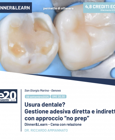 DR. RICCARDO AMMANNATO - Usura dentale?  Gestione adesiva diretta e indiretta con approccio “no prep”
