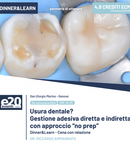 DR. RICCARDO AMMANNATO - Usura dentale?  Gestione adesiva diretta e indiretta con approccio “no prep”
