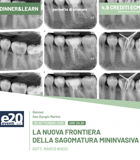 DINNER & LEARN - DOTT. MARCO BUCCI - LA NUOVA FRONTIERA DELLA SAGOMATURA MININVASIVA