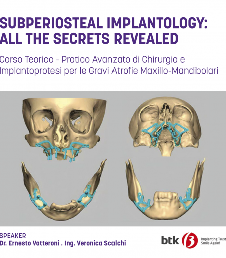 SUBPERIOSTEAL IMPLANTOLOGY: ALL THE SECRETS REVEALED