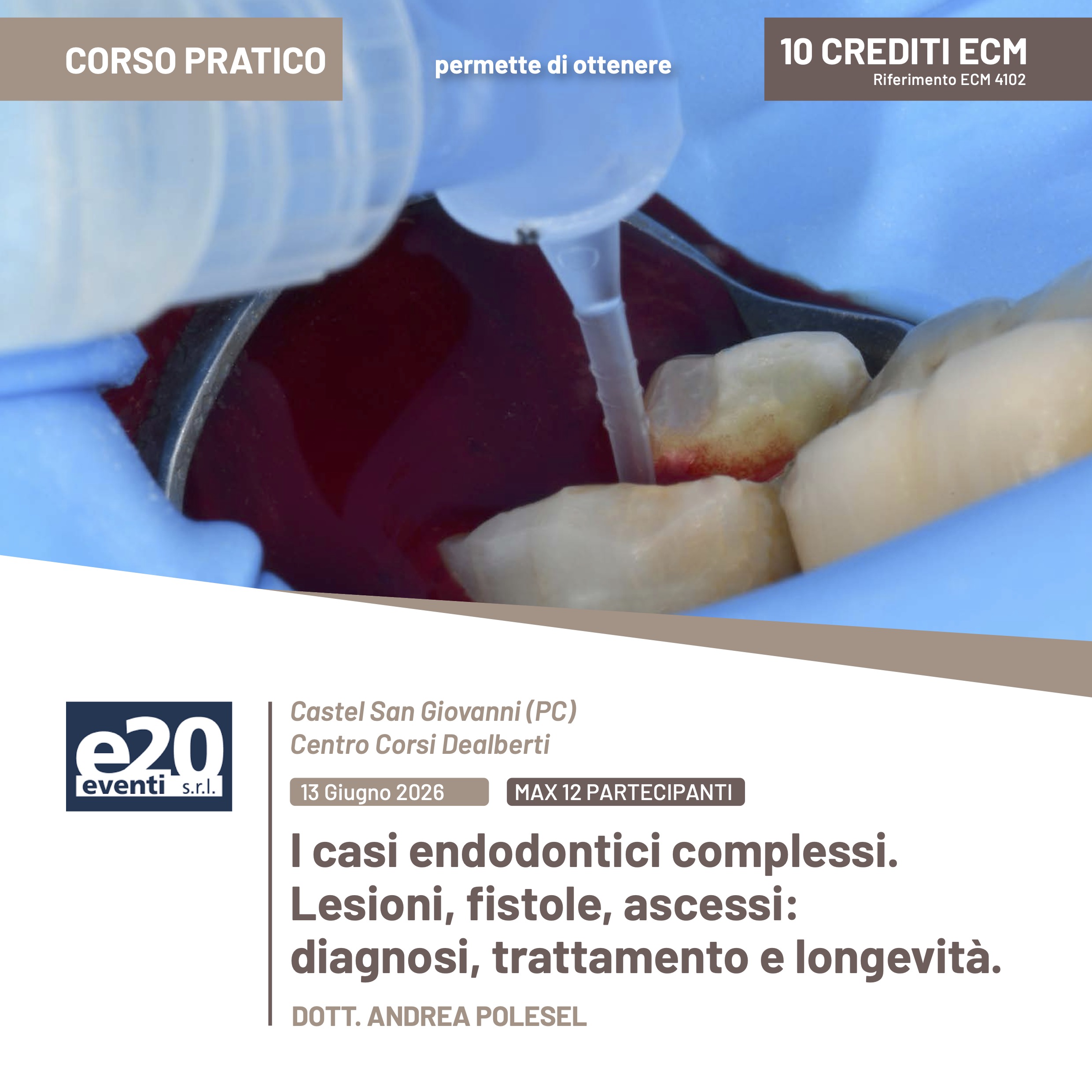 Dott. Polesel - I casi endodontici complessi. Lesioni, fistole, ascessi: diagnosi, trattamento e longevità.