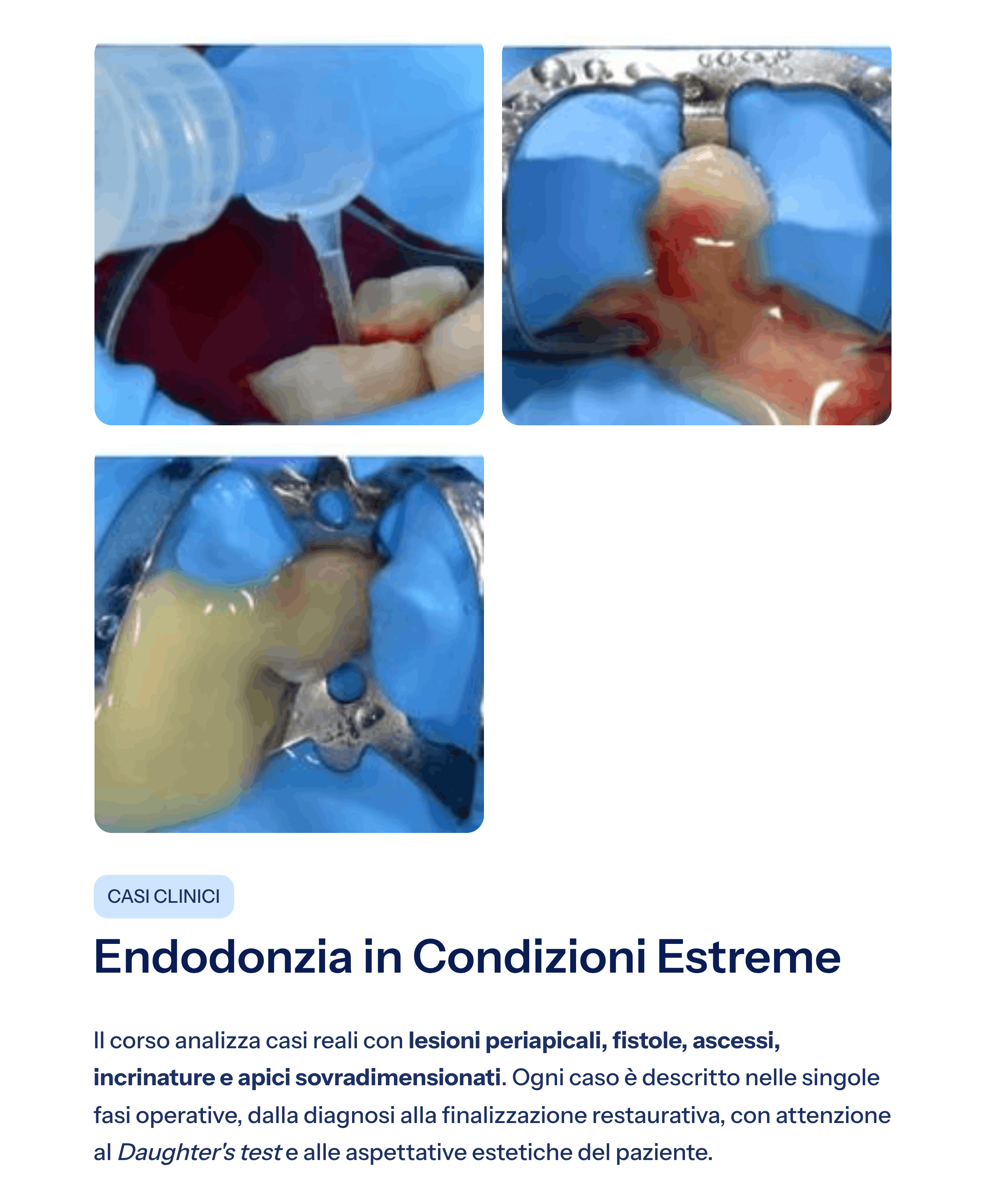 6_Endodonzia-in-Condizioni-Estreme