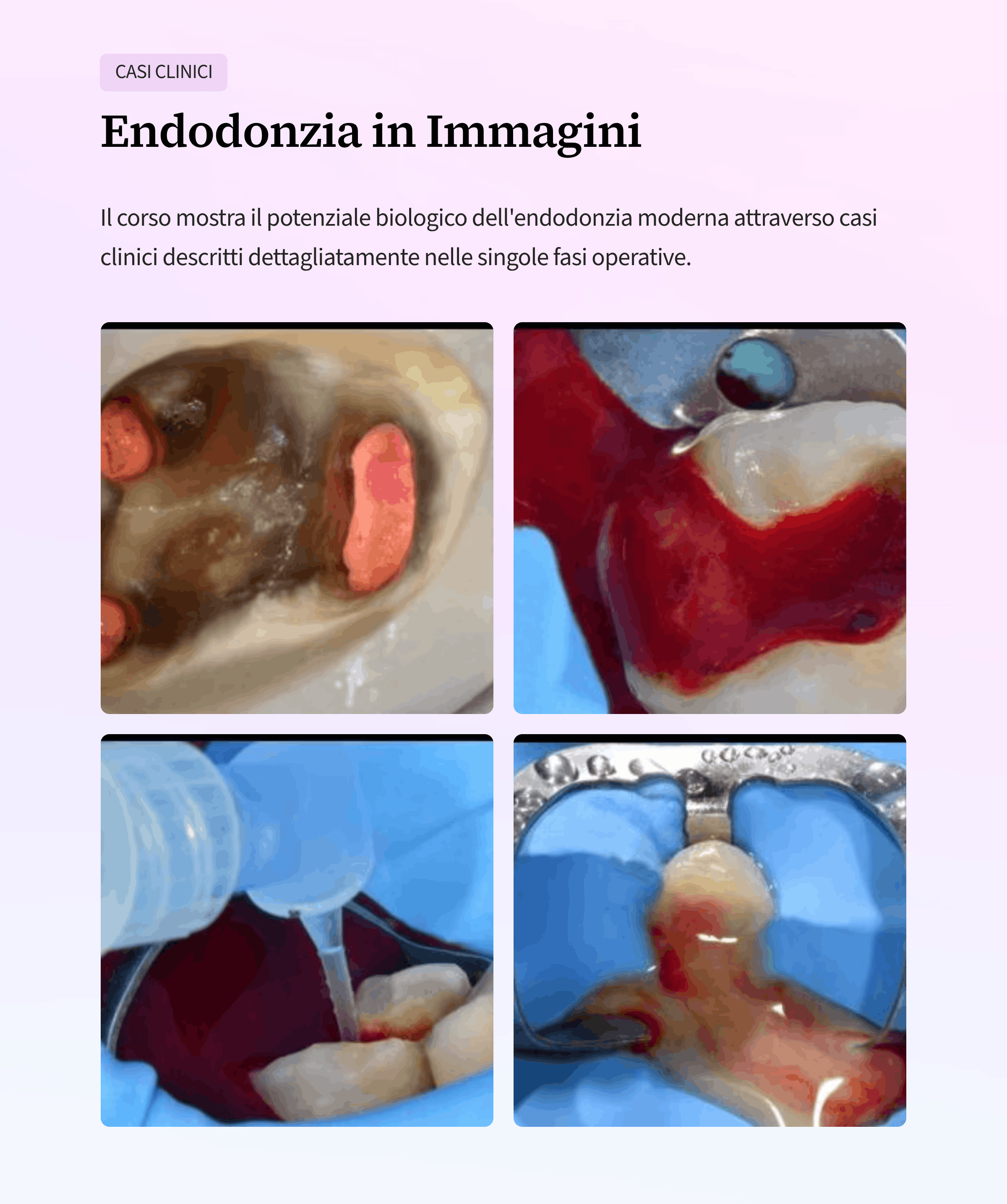 6_Endodonzia-in-Immagini