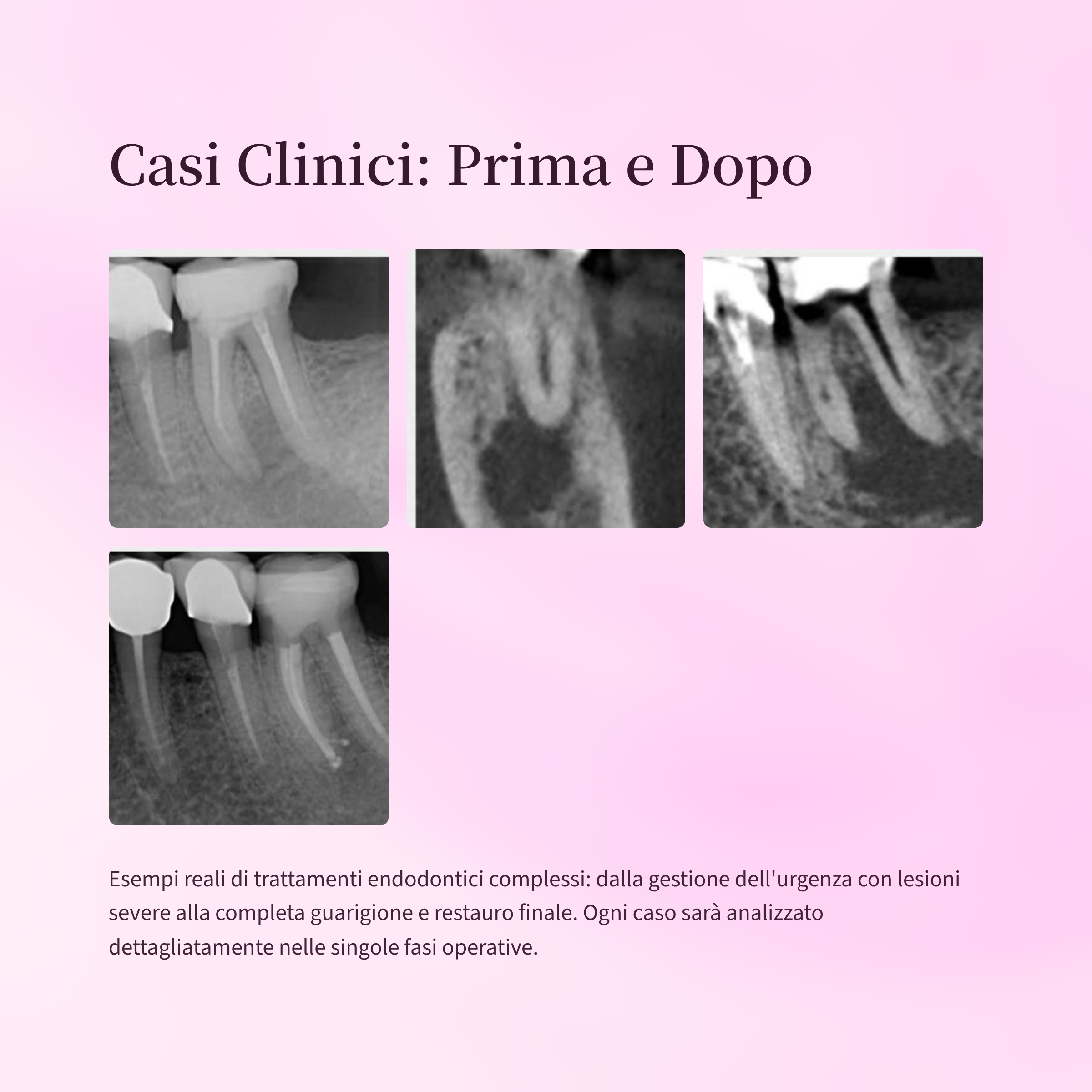 7_Casi-Clinici-Prima-e-Dopo