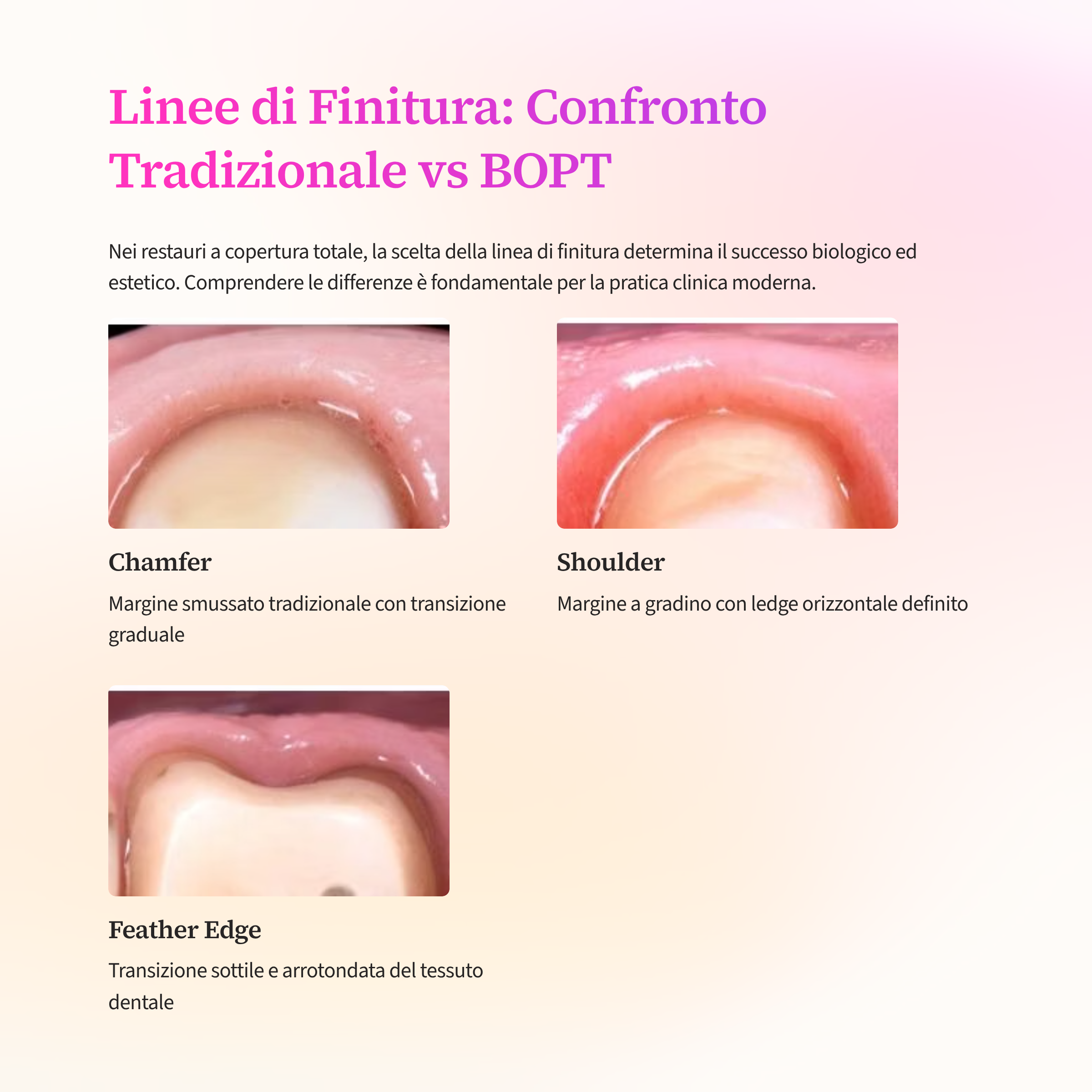 5_Linee-di-Finitura-Confronto-Tradizionale-vs-BOPT